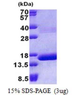 SDS-PAGE: Recombinant Human HBQ1 His Protein [NBP2-23114]