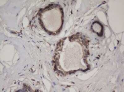 Immunohistochemistry: HBS1L Antibody (OTI1C1) [NBP2-45934]