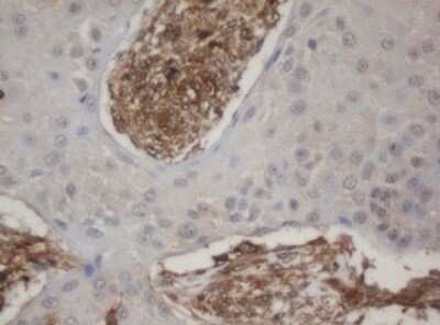 Immunohistochemistry: HBS1L Antibody (OTI1C1) [NBP2-45934]