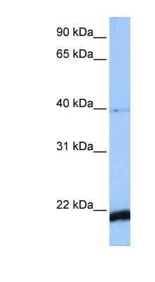 Western Blot: HBS1L Antibody [NBP1-52835]