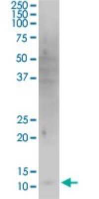 Western Blot: HBXIP Antibody (4G1) [H00010542-M12]