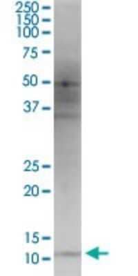 Western Blot: HBXIP Antibody (4G1) [H00010542-M12]