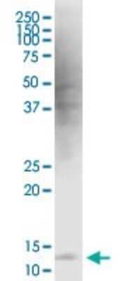 Western Blot: HBXIP Antibody (4G1) [H00010542-M12]