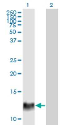 Western Blot: HBXIP Antibody (4G1) [H00010542-M12]