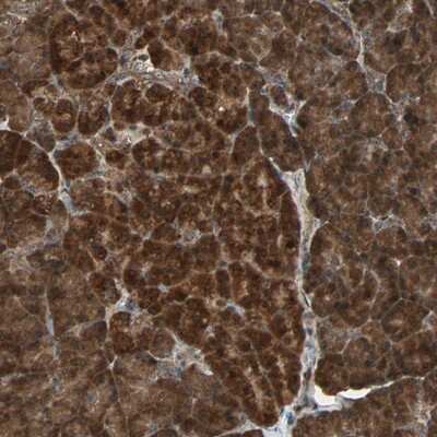 Immunohistochemistry-Paraffin: HBXIP Antibody [NBP1-82664]