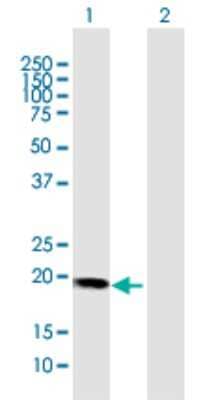 Western Blot: HBXIP Antibody [H00010542-D02P]