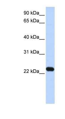 Western Blot: HBXIP Antibody [NBP1-53103]