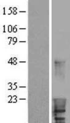 Western Blot: HBXIP Overexpression Lysate [NBL1-11465]