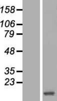 Western Blot: Hemoglobin zeta Overexpression Lysate [NBL1-11466]