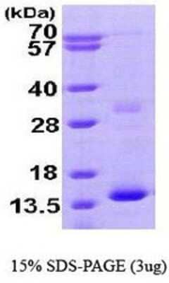 SDS-PAGE: Recombinant Human Hemoglobin zeta His Protein [NBP1-44486]