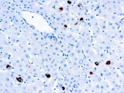 Immunohistochemistry-Paraffin: HBsAg Antibody (5C3) [NBP3-07121]