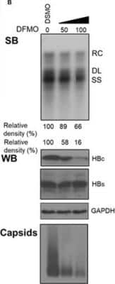 Western Blot: HBsAg Antibody [NB100-62652]