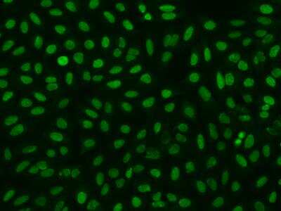 Immunocytochemistry/ Immunofluorescence: HCA59 Antibody [NBP3-06357]