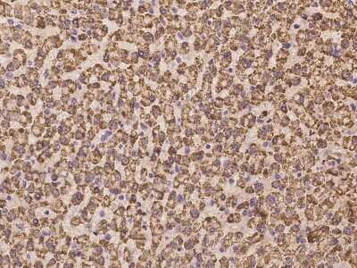 Immunohistochemistry: HCA59 Antibody [NBP3-06353]