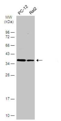 Western Blot: HCA59 Antibody [NBP1-32518]