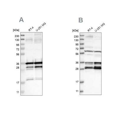 Western Blot: HCA59 Antibody [NBP1-83168]