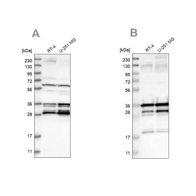 Western Blot: HCA59 Antibody [NBP1-83170]