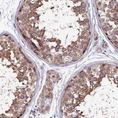 Immunohistochemistry-Paraffin: HCAP-G Antibody [NBP1-88199]