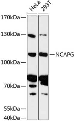 Western Blot: HCAP-G AntibodyAzide and BSA Free [NBP3-03775]