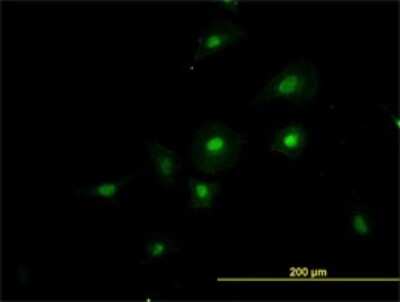 Immunocytochemistry/ Immunofluorescence: HCC1 Antibody (4G8) [H00009584-M01]