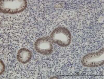 Immunohistochemistry-Paraffin: HCC1 Antibody (4G8) [H00009584-M01]