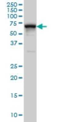 Western Blot: HCC1 Antibody (4G8) [H00009584-M01]