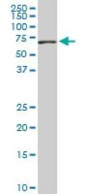 Western Blot: HCC1 Antibody (4G8) [H00009584-M01]