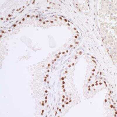 Immunohistochemistry-Paraffin: HCC1 Antibody - BSA Free [NB200-333]