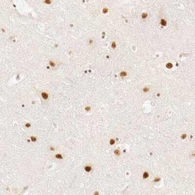 Immunohistochemistry-Paraffin: HCC1 Antibody [NBP1-88200]