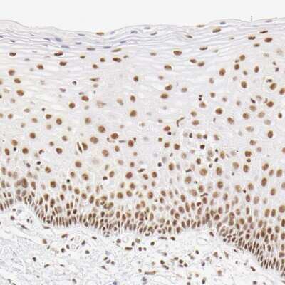 Immunohistochemistry-Paraffin: HCC1 Antibody [NBP1-88200]