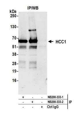 Immunoprecipitation: HCC1 Antibody - BSA Free [NB200-333]