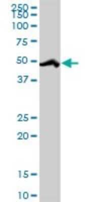 Western Blot: HCC1 Antibody [H00009584-D01P]