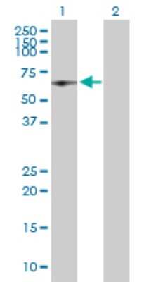 Western Blot: HCC1 Antibody [H00009584-D01P]