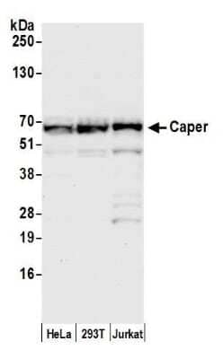 Western Blot: HCC1 AntibodyBSA Free [NB200-333]