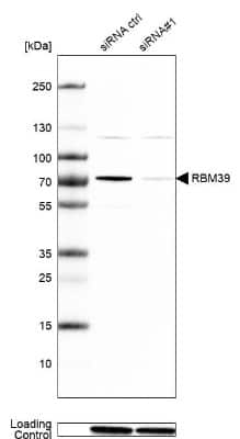 Knockdown Validated: HCC1 Antibody [NBP1-88200]