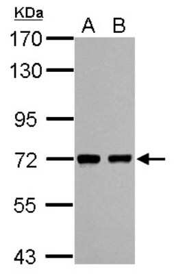 Western Blot: HCC1 Antibody [NBP2-16785]