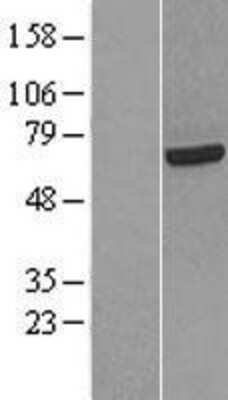 Western Blot: HCC1 Overexpression Lysate [NBL1-15210]