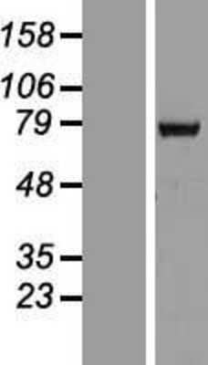 Western Blot: HCC1 Overexpression Lysate [NBP2-10543]