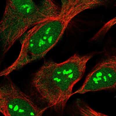 Immunocytochemistry/ Immunofluorescence: HCCA2 Antibody [NBP1-91978]