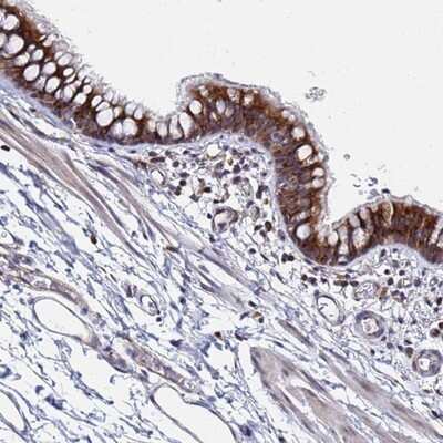 Immunohistochemistry-Paraffin: HCCA2 Antibody [NBP1-91978]