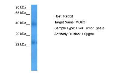 Western Blot: HCCA2 Antibody [NBP2-83034]