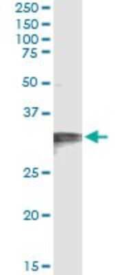 Immunoprecipitation: HCCS Antibody (3C7) [H00003052-M01]