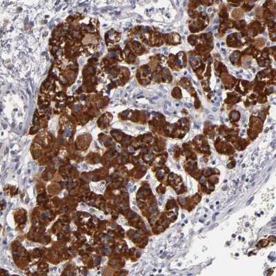 Immunohistochemistry-Paraffin: HCCS Antibody [NBP1-86577]