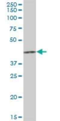 Western Blot: HCCS Antibody [H00003052-B01P]