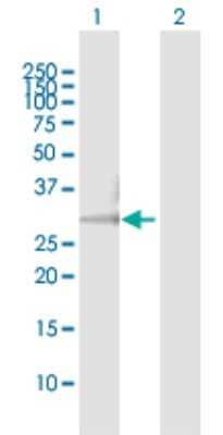 Western Blot: HCCS Antibody [H00003052-D01P]