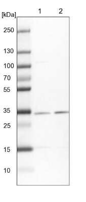 Western Blot: HCCS Antibody [NBP1-86577]