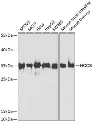 Western Blot: HCCS AntibodyBSA Free [NBP3-04609]