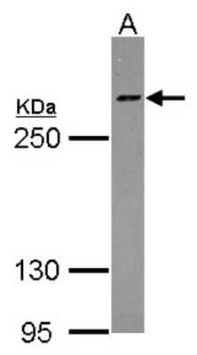 Western Blot: Host Cell Factor 1/HCFC1 Antibody [NBP2-16786]