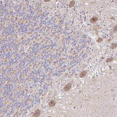Immunohistochemistry-Paraffin: HCFC1R1 Antibody [NBP2-31788]