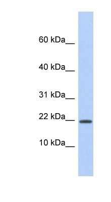 Western Blot: HCFC1R1 Antibody [NBP1-53070]